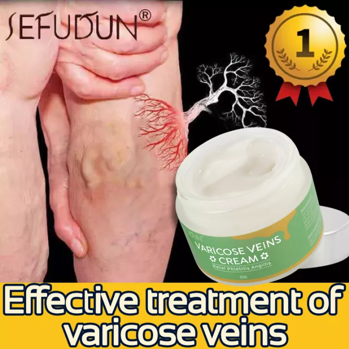 SEFUDUN Varicose Vein Ointment 50g Leg Cream Anti Varicose Veins Leg Treatment Treatment Of