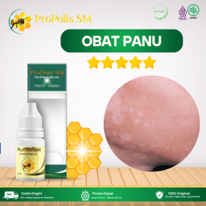 Obat Panu Obat Panu Anak Dan Dewasa Obat Oles Panu Panu Agar Cepat Hilang Obat Hapur Menahun Obat Penghilang Panu Di Seluruh Tubuh Obat Hapur Menahun Dengan Propolis SM