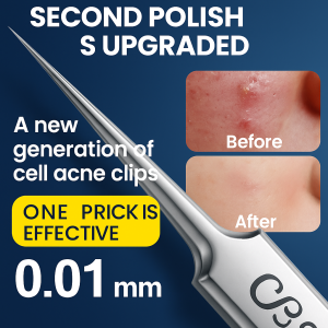 3 In 1 Blackhead Remover Kit Blackhead Remover Acne Remover Beauty Acne Removal Tool