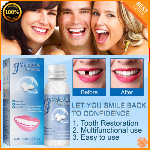 Moldable False Teeth Moldable Temporary Tooth repair teeth false teeth denture Original artificial Teeth whitening and Temporary Repair