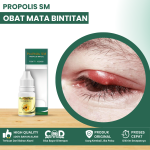 Obat Mata Bintitan Obat Kelopak Mata Bengkak Obat Benjolan Di Kelopak Mata Obat Oles Klazion Obat Timbilan Di Kelopak Mata Obat Bisul Di Kelopak Mata Obat Pengempis Mata Bintitan Dengan Propolis SM