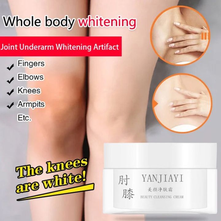 Skin Whitening Cream for Removing Black Spots on Joints and Buttocks