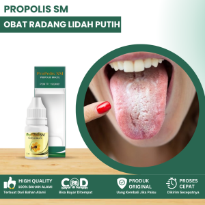 Obat Radang Lidah Putih Obat Baercak Putih Di Lidah Obat Lidah Putih Berjamur Kandidiasis Lidah Obat Lidah Pecah Pecah Lidah Terasa Pahit Lidah Mati Rasa Obat Lidah Meradang Infeksi Jamur Lidah Putih Dengan Propolis SM