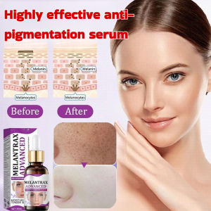 Whitening and Spot Lightening Essence with Moist Texture Easy to Absorb Gentle Refreshing and Non Irritating to Improve Dry Skin for Women美白淡斑精华液