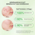 [55g] Glad2Glow Centella Allantoin Soothing Gel Moisturizer 55g Glad2Glow Moisturizer g2g Krim Wajah Pelembab Wajah Centella Moisturizer Acne Facial Cream Day Cream Night Cream Cream Malam Cream Siang Cream Wajah. 