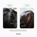 Bonvie Anti Dandruff Kemiri Tea Hair Tonic 60ml - Tonik Rambut Bonvie Anti Ketombe. 