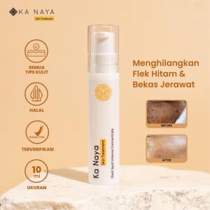 Ka Naya Skincare Dark Spot Intense C Skin Treatment Perawatan Penghilang Flek Hitam Di Wajah By Kanayaskin.id