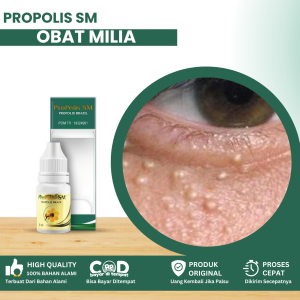 Obat Milia Obat Milia Di Bawah Mata Obat Penghilang Milia Di Kelopak Mata Obat Bintik Putih Di Wajah Obat Bruntusan Di Dekat Mata Bintik Kecil Di Bawah Mata Dengan Propolis SM