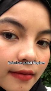 Reglow 2in1 TONER mengatasi bekas jerawat dan jerawat