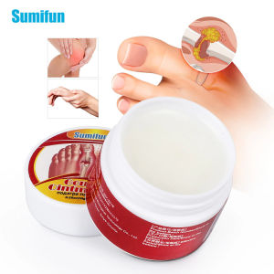 Sumifun Gout Ointment Hand Foot Thumb Arthritis Massage Cream Finger Joint Knee Ointment