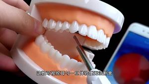 New Visual Ear Pick Wireless HD Smart Lighted Endoscope Ear Cleaning Visual Ear Pick