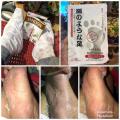Japan Foot Peeling Mask Foot Peeling Mask The Butterfly Foot Mask promises to help peel off layers of dead skin and callus. One pack contains a pair of sock-like masks filled with exfoliating solution 100% Authentic. 