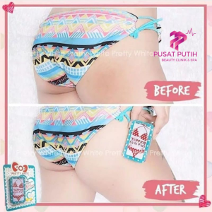 PEMUTIH BOKONG / PEMUTIH SELANGKANGAN / PEMUTIH KETIAK / PEMUTIH PAHA / TOPPING BALM