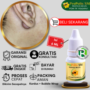Obat Benjolan Di Daun Telinga Obat Penghilang Keloid Bekas Luka Tindik Obat Benjolan Di Belakang Telinga Obat Infeksi Kuping Anting Tindik Benjolan di Telinga Kanan Dan Kiri - PROPOLIS SM 100% Original (BPOM & HALAL)