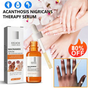 GiiMall Acanthosis Nigricans Repair Essence