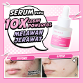 Hanasui Power Acne Serum - Jerawat & Beruntusan Menenangkan & Kurangi Produksi Minyak Salicylic Acid dan Glycolic Acid. 