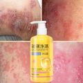 Sumifun Beauty Eczema Body Wash 500ml / Sabun Eksim / Sabun Gatal Kulit Ampuh / Sabun Jerawat Punggung / Sabun Mandi Cair. 