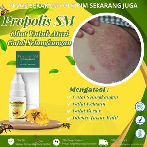 Propolis Sm - Obat Gatal Di Selangkangan Selangkangan Hitam Gatal Pantat Masalah Kulit