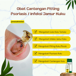 Tetes Oles Cantengan - Obat Cantengan Kaki Propolis SM BRAZIL