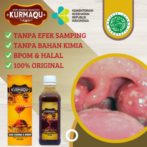Obat Herbal Untuk Sakit Tenggorokan Tenggorokan Kering Tenggorokan Gatal Susah Menelan Nyeri Menelan Iritasi Tenggorokan Radang Tenggorokan Radang Amandel Anak Dan Dewasa Bisa Untuk Ibu Hamil Dan Menyusui KURMAQU