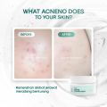 Acneno - Bundle Acne Moist Basic Paket Skincare Acne Serum 12ml & Pelembab Wajah Daily Acne Moisturizer 50g. 