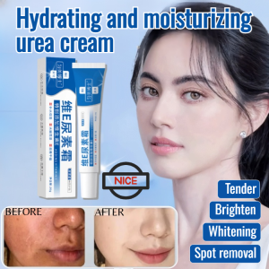 Whitening Urea Cream with Vitamin E Spot Removal Treatment for Hydrated Soft Glowing Skin Smoothing Face Cream