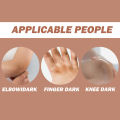 Eelhoe Strong Effective Dark Knuckles Remover Serum Powerful Whitening Cream Hand Knuckle Cream For Elbow And Knee Black Skin Dark Feet Whitening Cream Fast Whitening Cream For Dark Feet Dark Knees And Elbows Strong Whitening Cream 50g. 