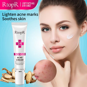 RtopR Mango Acne Treatment Cream Blackhead Repair Gel Serum Control Shrink Pores Scar Whitening Moisturizer Cosmetics Skin Care