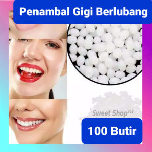 SWS TEMPTOOTH 100 BUTIR PENAMBAL GIGI BERLUBANG