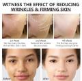 CHALONESE KRIM Pemutih Dan Penghilang Flek Hitam Chalonese Whitening Dan Freckle Removal. 