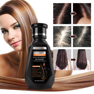 Hair Growth Shampoo 250ml / Essential Oil 30ml Anti-Hair Loss Reduce Hair Fall Oily Scalp Strengthen Hair Root