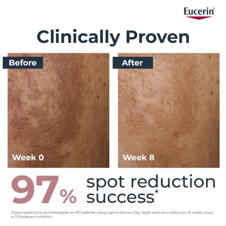 EUCERIN%20Spotless%20Brightening%20Booster%20Serum%2030ml%20-%20Image%207