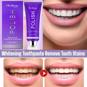 Toothpaste Gently Cleans And Removes Tooth Stains Improves Yellow Teeth And Freshens Breath
