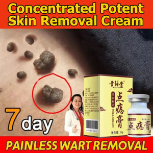 Concentrated Potent Skin Removal Cream Body Warts Cream Spot Mole Ointment