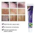 SUMIFUN Antibacterial Cream Gamot Sa Pigsa Gamot Sa Kati Kati Sa Balat Ointments For Skin Deases Cream Para Sa Kati Kati. 