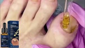 Wiyun Nail Treatment Oil Nourishing and repairing oil for soft and thick nails on hands and feet for daily cleaning and care