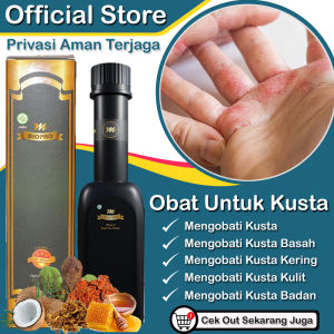 Obat kusta kering kusta basah kusta kulit matirasa ampuh M-BIOPRO asli original