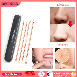 4 Pcs Stainless Steel Blackhead Remover Needle Tool Kit Professional Blackhead Acne Comedone Pimple Blemish Extractor Beauty Tool