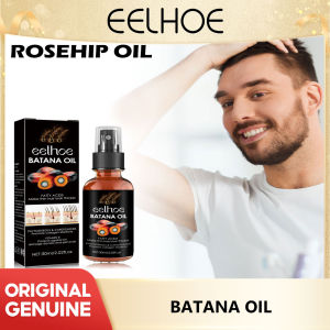 Eelhoe Hair Growth Spray Batana Oil Hair Spray Essential Oil Hair Nourishing Essential Oil Anti Hair Loss Spray Hair Growth Spray Scalp Treatment Deep Cleaning Follicles Prevent Baldness Alopecia Nourishing Thicken Anti Hairs Loss Spray