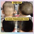 Minyak Kemiri Penumbuh Rambut Bayi Cepat FORA. 