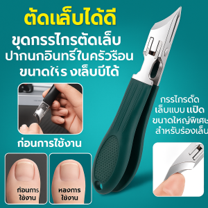 ชุดกรรไกรตัดเล็บที่บ้าน ชุดกรรไกรตัดเล็บแบบเปิดขนาดใหญ่พิเศษสําหรับร่องเล็บ