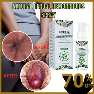 Agdoad Hemorrhoids Spray Hemorrhoid Cream Cream Relieves Hemorrhoid Pain Itching Discomfort Redness 30ml