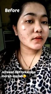 BG Skin Beauty Glow Brightening Acne Cica Soothing Cream Original