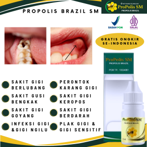 Propolis SM Brazil Asli Original 100% Obat Sakit Gigi Obat Sakit Gigi Berlubang dan Gusi