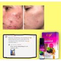 ‼️💯ORI HQ‼️GRAPESEED OIL LUVLY OIL (MINYAK ANGGUR) | GLOWY SERUM |5g FILTER CREAM | CANDY PUDING MONTOX🔥🔥. 