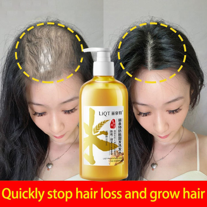 Hair Loss Shampoo Hair Growth Shampoo Ginger Shampoo 500ml Anti Hair Loss Promotes Hair Growth 8684