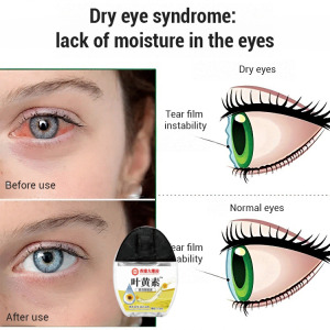 Eye Care Solution Lutein One Drops