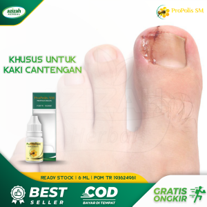 Obat Tetes Cantengan Jempol Kaki dan Tangan - Obat Kuku Bengkak - Obat Kuku Berjamur - Obat Cantengan Jempol Kaki Bernanah - Obat Cantengan Parah - Obat Kuku Rusak - Obat Infeksi Kuku Jempol Bau - Obat Pembersih Kuku Hitam - ProPolis SM 6ml