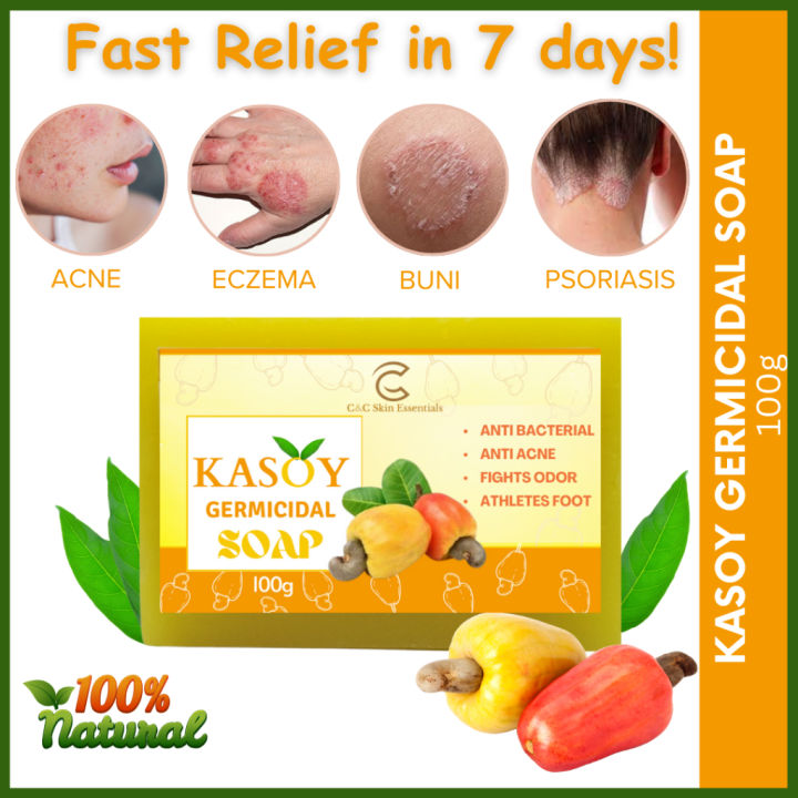 Kasoy Soap Original: Your Natural Remedy for Itchy Skin, Buni, Allergy, Acne, Pimples and Eczema