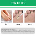 Jaysuing Warts Remove Liquid Smooth Skin Gentle Foot Care Ready Stock Wholesale. 
